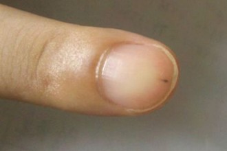 手上这东西 竟然是恶癌