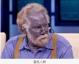 世界上竟有蓝色人种,血液也是蓝色的