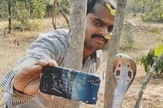 印度男子长出巨人手臂 被称“恶魔之子”