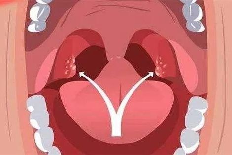 孕期嗓子痛怕吗？