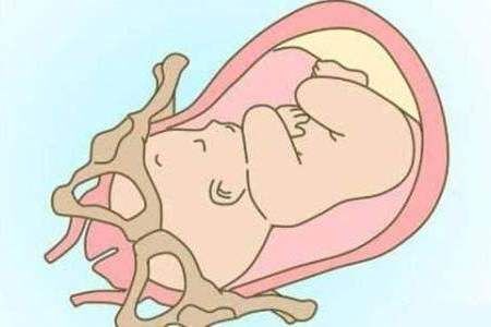 宫口要开十指？这也太吓人了吧