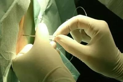 剖腹产术后为什么需要平躺6个小时呢？ ​