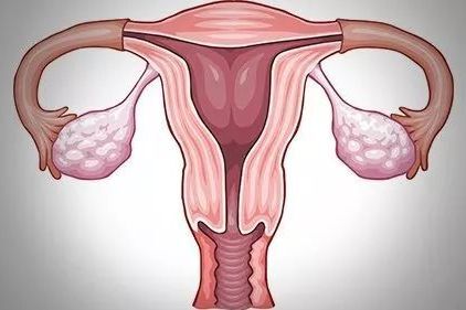 后位子宫影响怀孕？