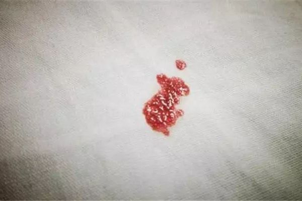 同房以后出血是捣鼓早了还是另有隐情？ ​