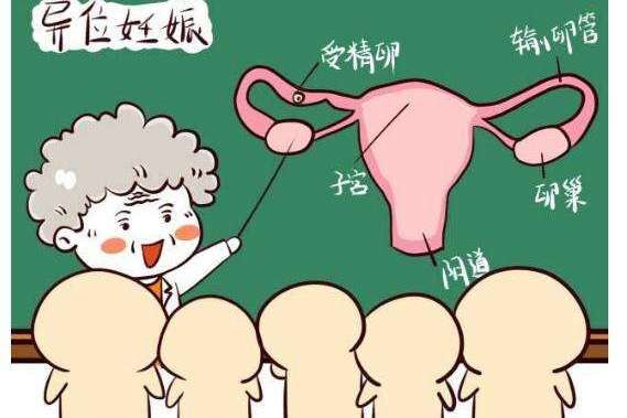 如何避免宝宝在别处安家？  ​