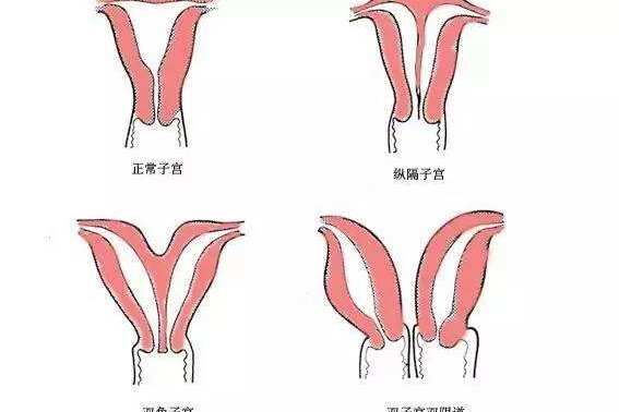 子宫颜值不高可以整形吗？