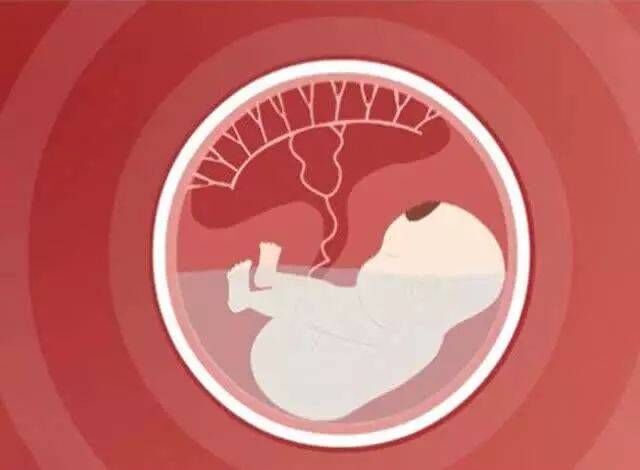 胎盘低置还分叶能顺产吗