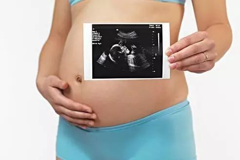 双胞胎姐妹怀孕也组团？ ​