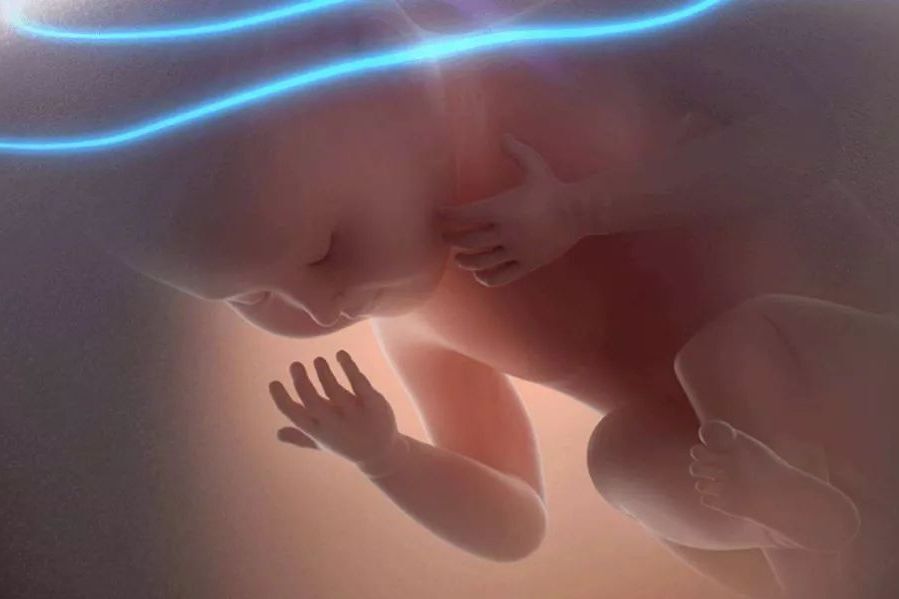 宝宝没有鼻梁怎么办？