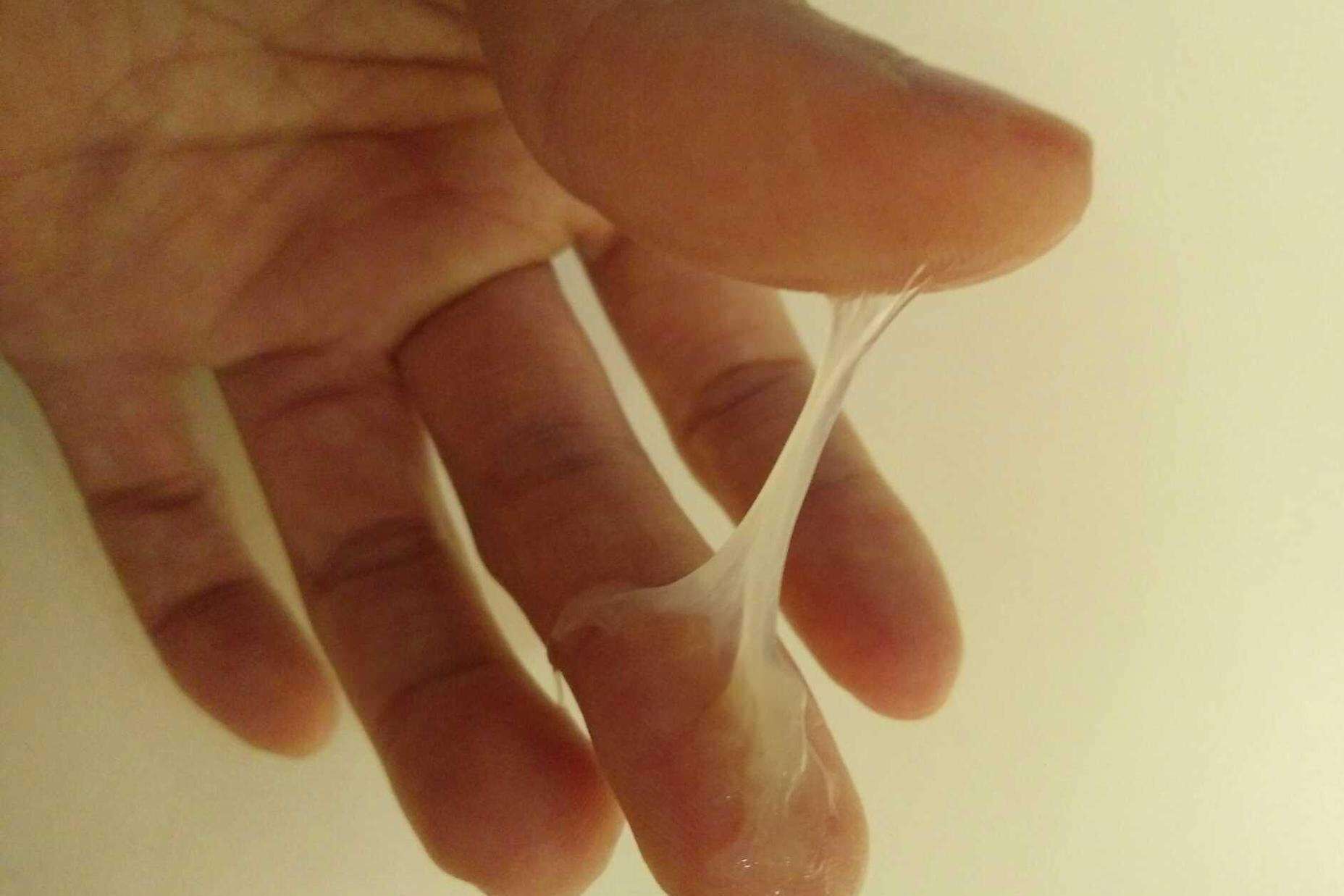 你的白带有拉丝吗？