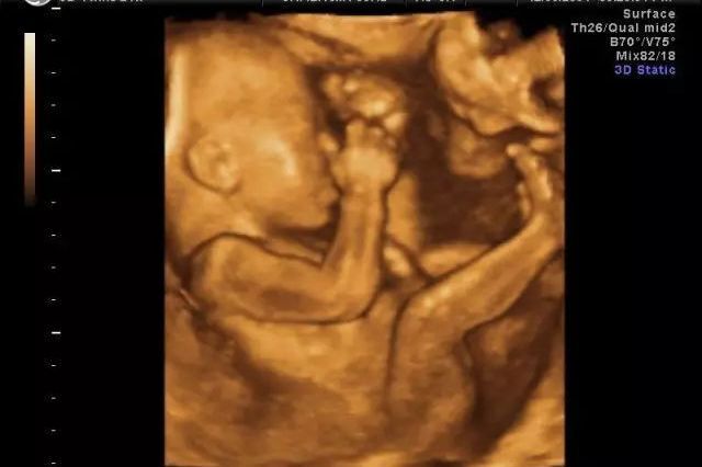 错过了四维时间怎么办？