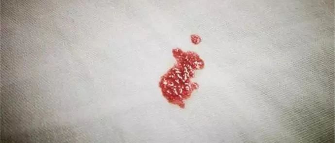 宝宝刚安家不能流血