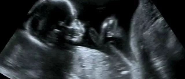 是公主还是王子，几秒钟就确定了