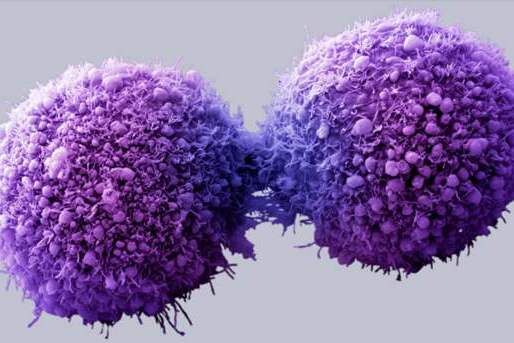 减少&ldquo;细胞胶水&rdquo;！澳大利亚科学家发现防止癌症转移的关键