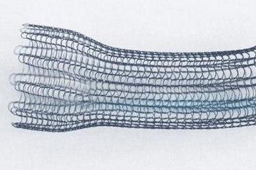 搜狐科学 |&nbsp;尿道狭窄有了新办法！科学家发明4D打印胎儿尿道支架 