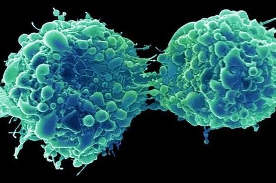 英国膀胱癌患者在感冒后痊愈，竟然是病毒杀死了癌细胞