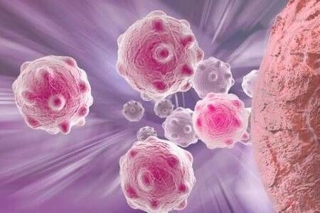 科学家发现肿瘤的致命弱点，阻断ATF4蛋白能让癌细胞自我毁灭