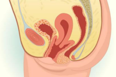 子宫前位好还是后位好，怎么判断子宫前位后位？