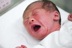 新生儿丑到亲妈都嫌弃，医生却说很漂亮？一个月后家人才恍然大悟