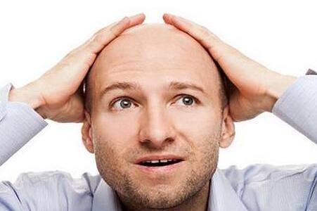 不想变成&ldquo;地中海&rdquo;，你需要了解自己的体质再对症下药