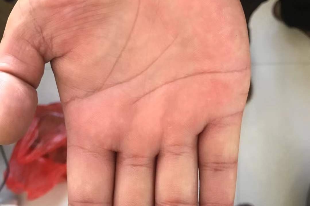 有这些纹路的手相，最有福气