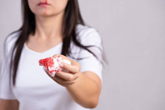 流鼻血的原因找到了！干燥只是一部分，排在第一或许很多人都有