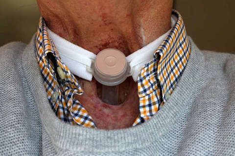 吃饭时这种现象，暗示癌症已到中晚期？