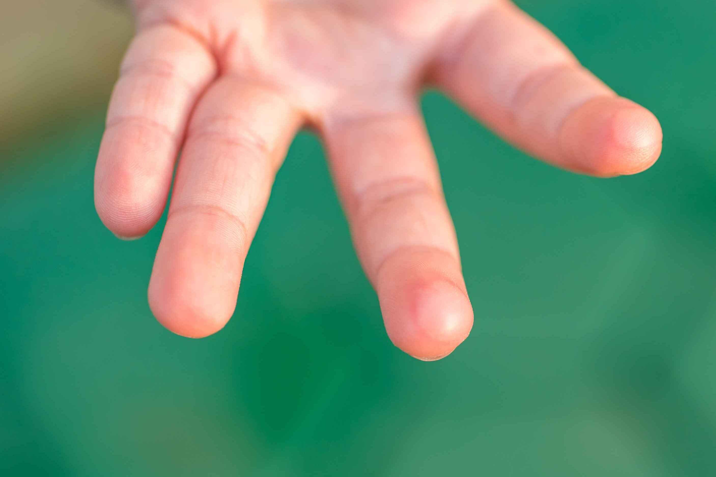 被虾尾刺破手，为何会引起脏器衰竭？这种吃人的病菌，谁都没想到