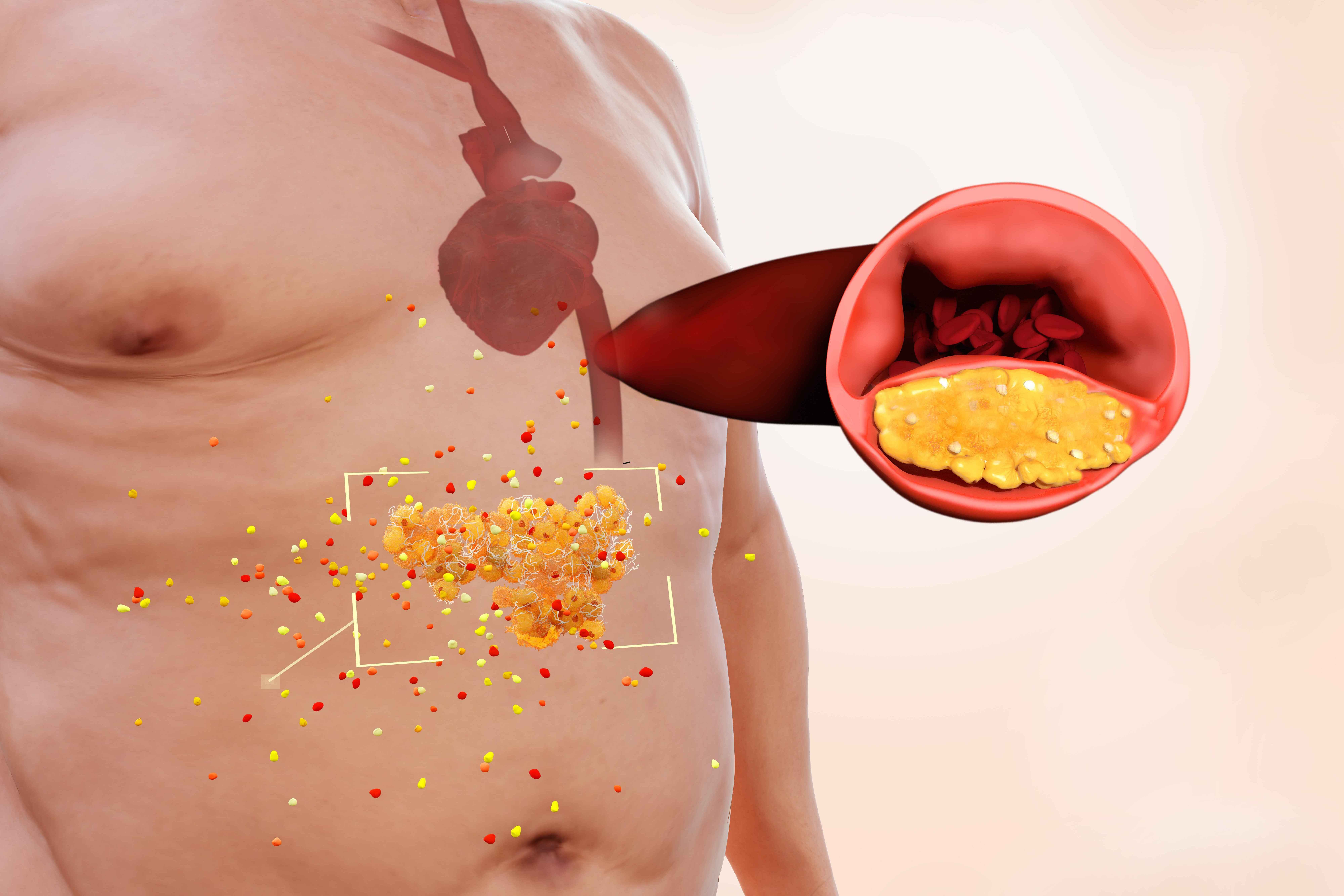 血稠的元凶找到了！高糖排在第二位，排在首位的你每天都在吃