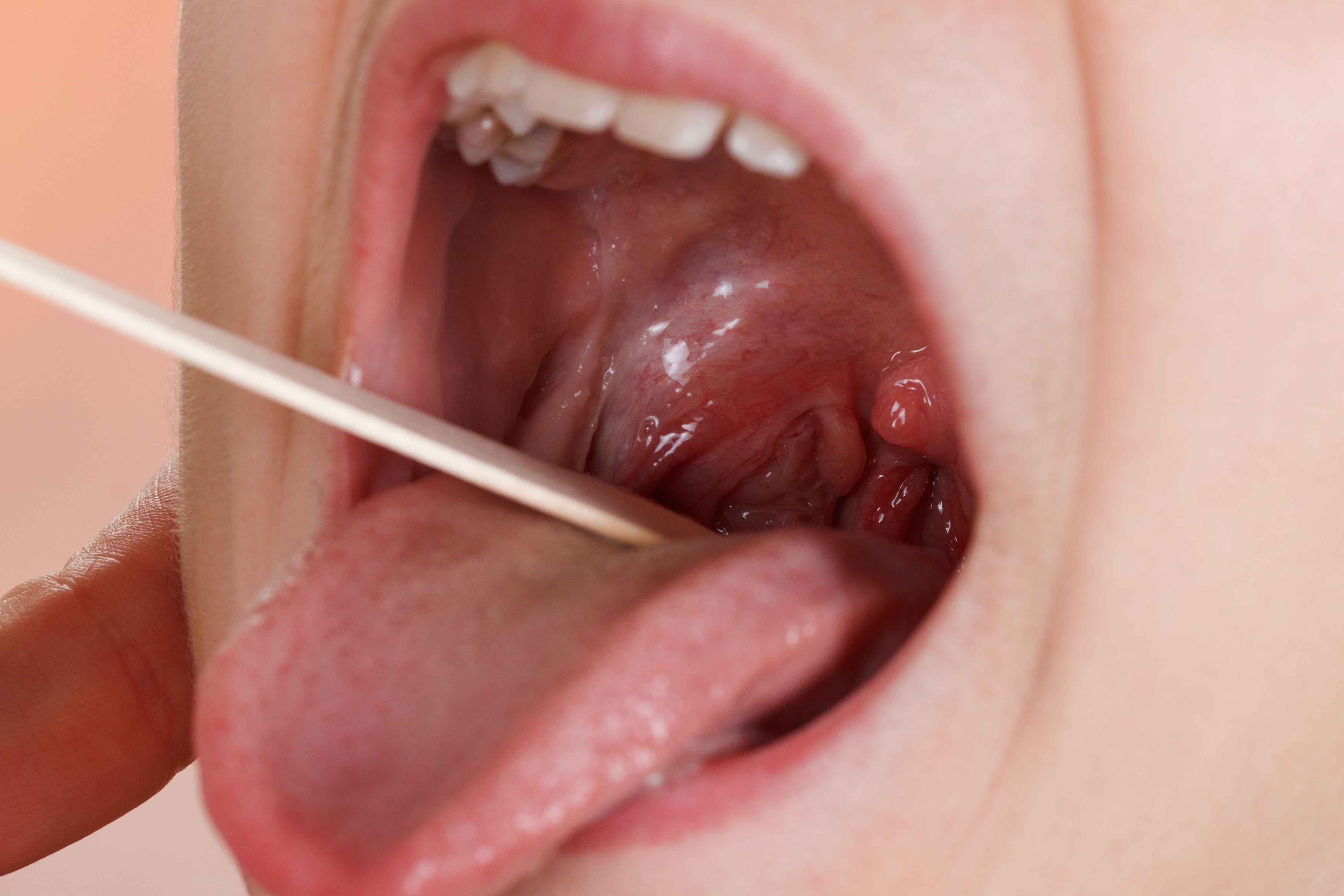 看舌头，知全身？就为这个舌头误区，专家与医生吵了一辈子！