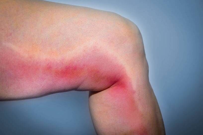 晚上睡觉时，若身体出现这4个&ldquo;异样&rdquo;，留个心眼：可能血栓来了