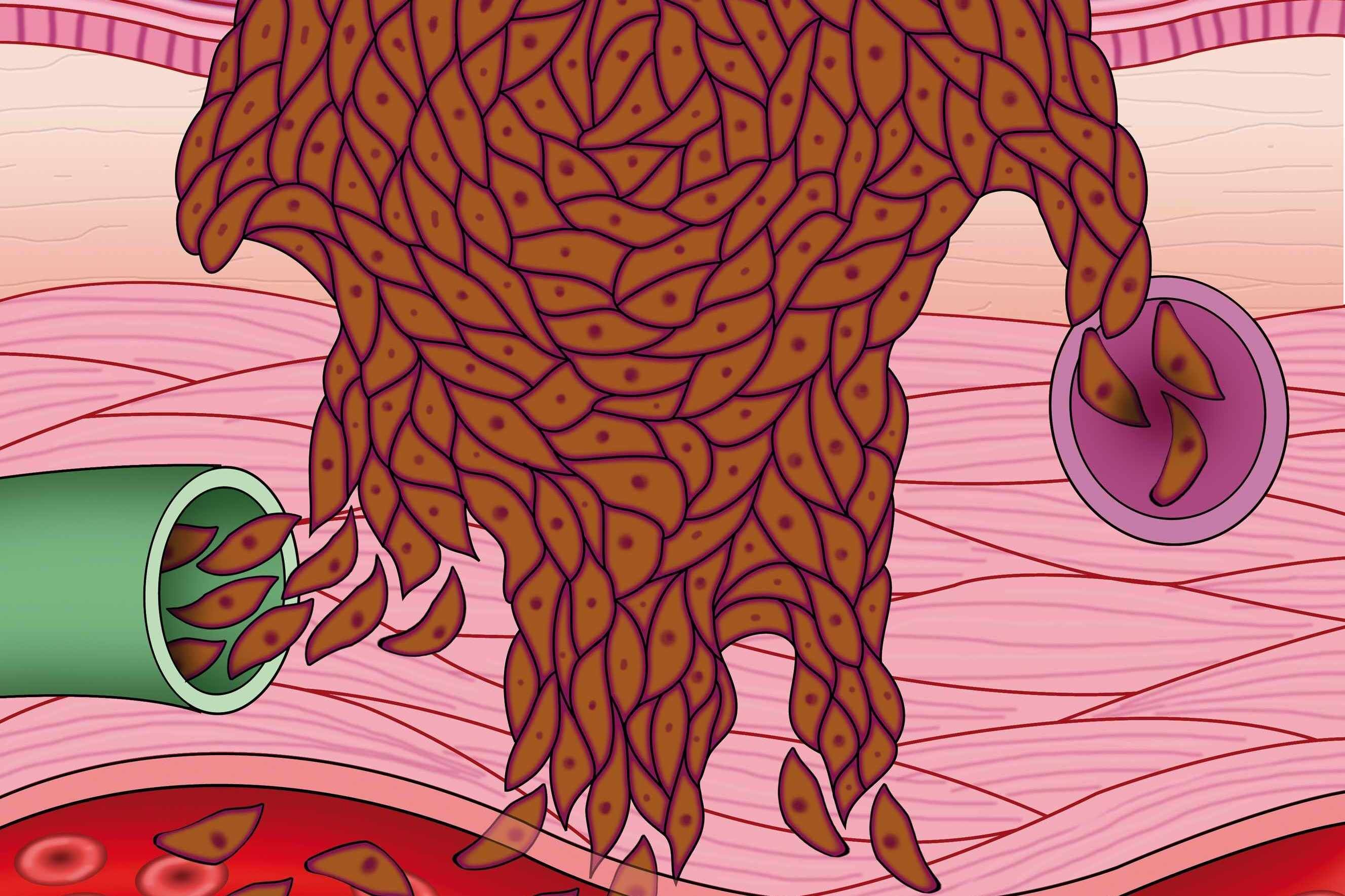 10个不良习惯，让心血管疾病离你越来越近，自查后尽快改