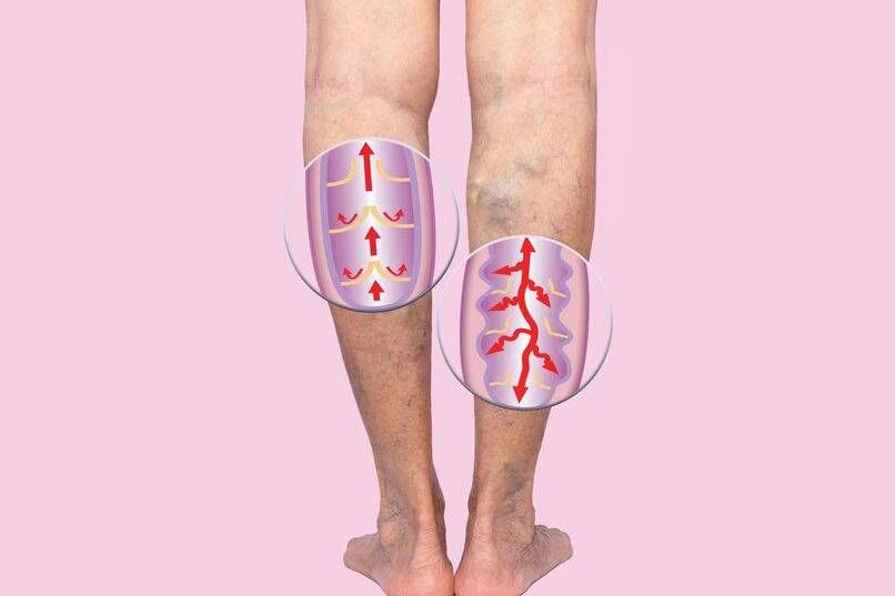 晚上睡觉时，若都出现4个现象，很抱歉，血栓已&ldquo;占领&rdquo;你的身体