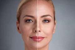 别再注射肉毒杆菌了！澳洲人早就把这种成分，运用到面膜中了！