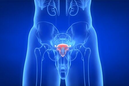 前列腺炎三大克星食物 性生活有益康复