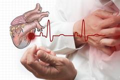 一盆冷水引起的急性心肌梗死，天气虽然热，但洗澡别&ldquo;逞能&rdquo;