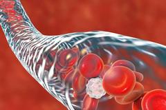 为什么说&ldquo;血管多大寿，人就活多久&rdquo;？如何保养好自己的血管呢