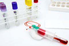 血脂高了怎么办，如何控制血脂，避免给健康带来麻烦呢？