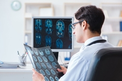 有的人血压、血脂、血糖都不高，为什么也会患脑梗死？