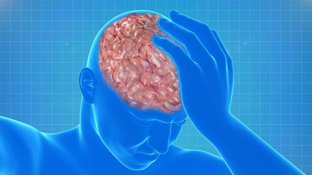 脑梗患者越来越多，医生提醒：少吃3物、戒4事，血管不堵人长寿
