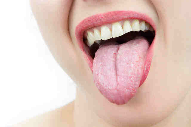 舌头两边有齿痕，是怎么了？中医分析2种原因，附调理建议